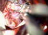 aneurisma_2.jpg (76289 byte)