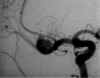 angio_1.jpg (94252 byte)