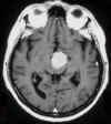 clivusalto_1.a.jpg (31983 byte)