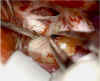 craniof-.jpg (69235 byte)