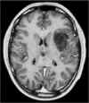 insula-1.a.jpg (37725 byte)