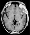 insula-2.b.jpg (40098 byte)