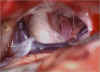 mdv_1.jpg (40951 byte)