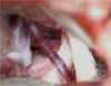 mdv_2.jpg (45505 byte)