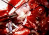 neurinomaspin.jpg (322544 byte)